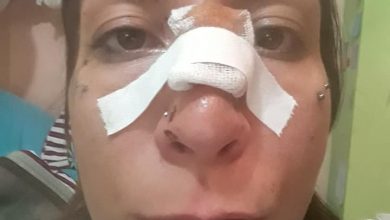 Photo of (ФОТО) Моника Ристеска: Татко ми ме претепа зашто бев да земам чипс од шкафчето во кујна