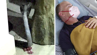 Photo of Кобра гризна Британец кој прележал маларија, денга треска и Ковид-19