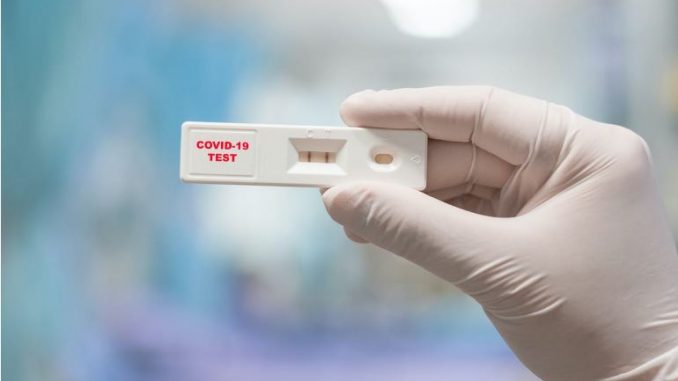 kovid_korona_test_4756