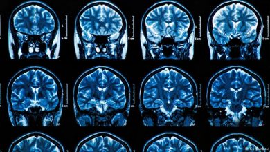 Photo of Невролозите укажуваат на „облак“ во меморијата и автоимуни болести како последица на Омикрон