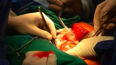 Photo of Скандал во Грција –15 деца починале по операција од ист кардиохирург