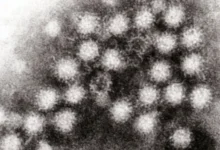 Photo of Над 900 луѓе заразени со норовирусот во северна Италија