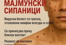 Photo of Мајмунски сипаници во Македонија – епидемиологот Даниловски вели дека не се пренесуваат лесно и мал е ризикот за епидемија