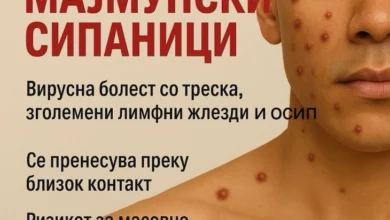 Photo of Мајмунски сипаници во Македонија – епидемиологот Даниловски вели дека не се пренесуваат лесно и мал е ризикот за епидемија