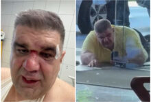 Photo of Во Загреб брутално претепан српски бизнисмен, продуцент и сопственик на Хајп ТВ