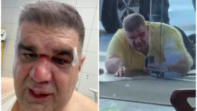 Photo of Во Загреб брутално претепан српски бизнисмен, продуцент и сопственик на Хајп ТВ