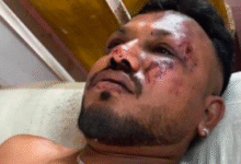 Photo of ВИДЕО Прва снимка од преживеаниот во авионската несреќа во Индија: „Сè се случи толку брзо“
