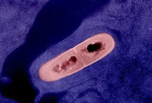 Photo of Едно лице починало од листериоза, две други заболеле, ИЈЗ повикува на внимателност со храната