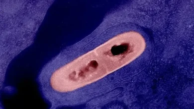 Photo of Едно лице починало од листериоза, две други заболеле, ИЈЗ повикува на внимателност со храната