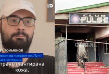 Photo of Повредениот Игор од Кочани до политичарите: Одлепете се од камери, ние имаме потреба од медицинска помош, секој ден ни е нов предизвик