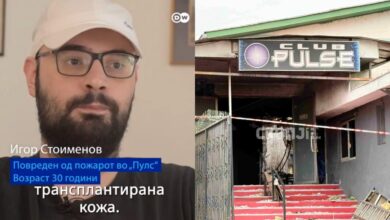 Photo of Повредениот Игор од Кочани до политичарите: Одлепете се од камери, ние имаме потреба од медицинска помош, секој ден ни е нов предизвик