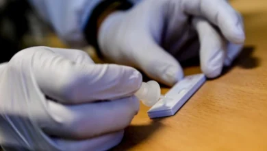 Photo of Вирусот мпокс може да го инфицира и човечкиот мозок, покажува истражување на швајцарски научници