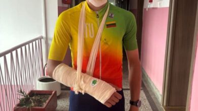 Photo of „Дојдоа да се натпреваруваат, а ги однесовме на хирургија“- еден од удрените исландски велосипедисти има скршена рака и повреди на главата