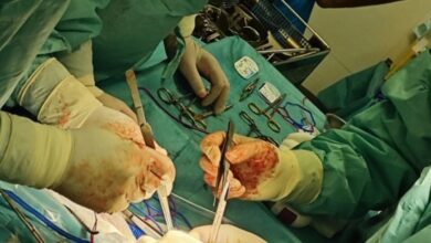 Photo of МЗ: Уште една трансплантација на органи од починат донор е извршена на 9 август
