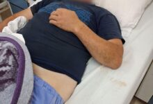 Photo of Го натепале затоа што им рекол дека ќе изгубат на избори – МВР го потврди насилството во Струмица