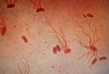 Photo of Во РС потврден случај на тифус кај студентка од Индија