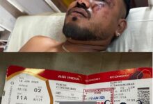 Photo of Единствениот преживеан во авионската несреќа на Ер Индија во која загинаа 241 лице: „Не сакам да разговарам со никого“