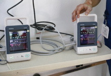 Photo of ТАВ Македонија донираше најсовремена медицинска опрема на клиниката за респираторни заболувања кај децата Козле