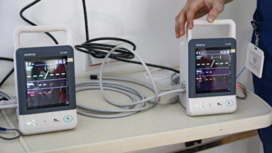 Photo of ТАВ Македонија донираше најсовремена медицинска опрема на клиниката за респираторни заболувања кај децата Козле