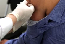 Photo of Здравствените работници ќе може бесплатно да се вакцинираат против хепатитис Б