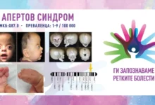Photo of „Ги запознаваме ретките болести“: Апертов синдром