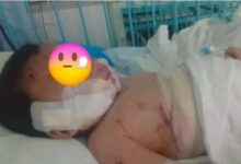 Photo of (Видео) Тешка е здравствената состојба на двегодишникот искасан од куче