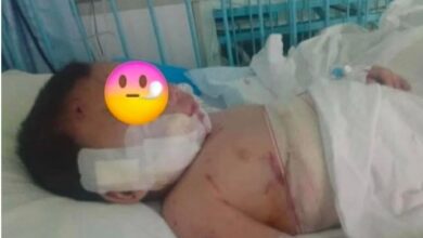 Photo of (Видео) Тешка е здравствената состојба на двегодишникот искасан од куче