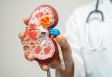 Photo of Истражување: Научници открија бактерии во бубрежни камења