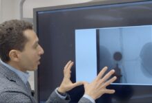 Photo of Болниците во Македонија да проверат уште колку хелиум имаат за апаратите за магнетна резонанца, поради војната во Иран