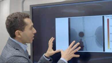 Photo of Болниците во Македонија да проверат уште колку хелиум имаат за апаратите за магнетна резонанца, поради војната во Иран