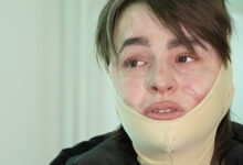 Photo of (Видео) Исповед на преживеана од „Пулс“: По комата започна борбата за живот, а денес сфаќам дека ништо не вреди ако не си здрав