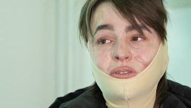 Photo of (Видео) Исповед на преживеана од „Пулс“: По комата започна борбата за живот, а денес сфаќам дека ништо не вреди ако не си здрав