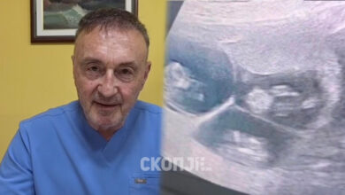 Photo of  Д-р Трпчевски откри редок случај: Жена на 58 години остана бремена со тројка по ин витро оплодување