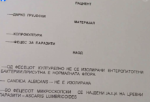 Photo of Пронајдени јајца од цревен паразит кај екс-кандидат за градоначалник на Гостивар по пиење на водата со фекалии