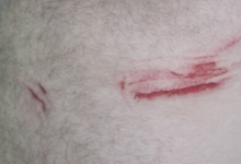 Photo of (Видео) Затвореници од Шутка пријавиле дека биле натепани од Единицата за интервенции на затворската полиција, еден од нив однесен и во болница