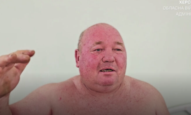 Photo of (ВИДЕО) Руски дрон нападна и повреди продавач на пазар во Херсон